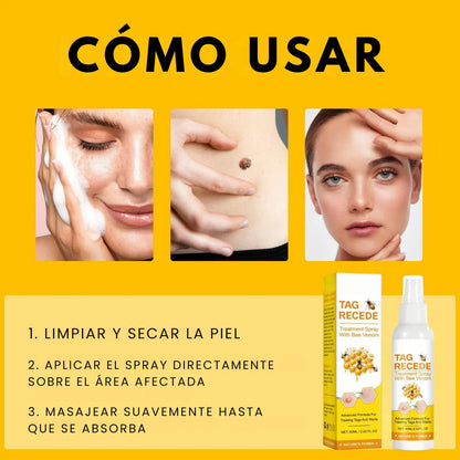Spray Bee Venom – Elimina verrugas de forma segura, sin dolor ni cicatrices
